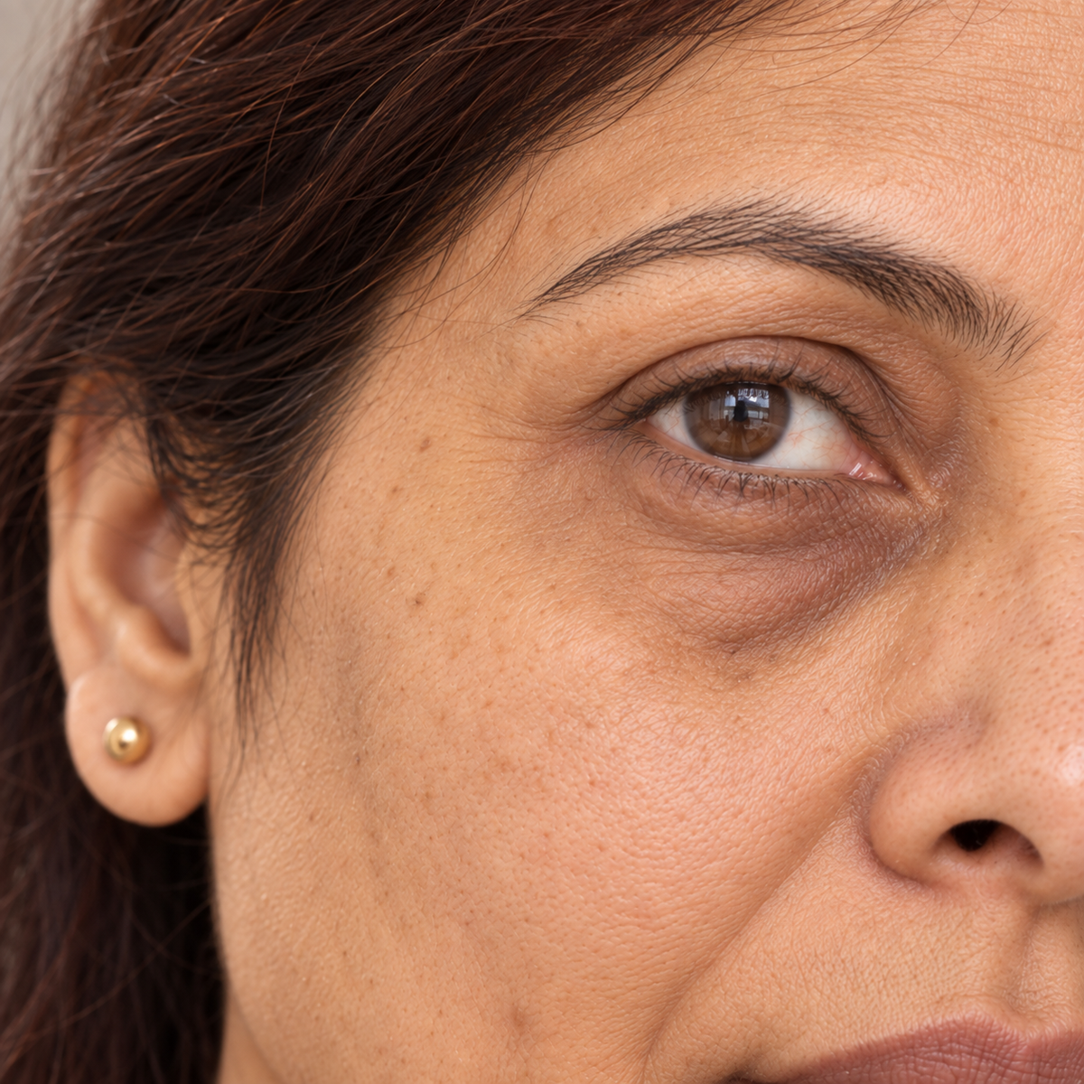 Product-page source image: skin concern eyes